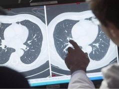 VACCIN CONTRE LE CANCER DU COL DE L’UTÉRUS : Plus d’un million de vies sauvées dans les pays pauvres