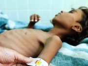 REPUBLIQUE DEMOCRATIQUE DU CONGO : Plus de 4 millions d’enfants de moins de cinq ans menacés de malnutrition aiguë