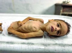 LE PETIT MOHAMED ZAKARIA KHADR SUCCOMBE À LA MALNUTRITION À GHAZA : Témoin d’une famine orchestrée