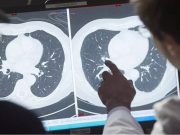 VACCIN CONTRE LE CANCER DU COL DE L’UTÉRUS : Plus d’un million de vies sauvées dans les pays pauvres