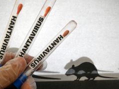 BIEN QUE LE NIVEAU DE RISQUE EN ALGÉRIE RESTE FAIBLE ET BAS : Les autorités augmentent le niveau de vigilance face à l’hantavirus